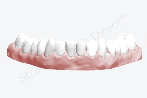 a-great-example-of-cosmetic-improvement