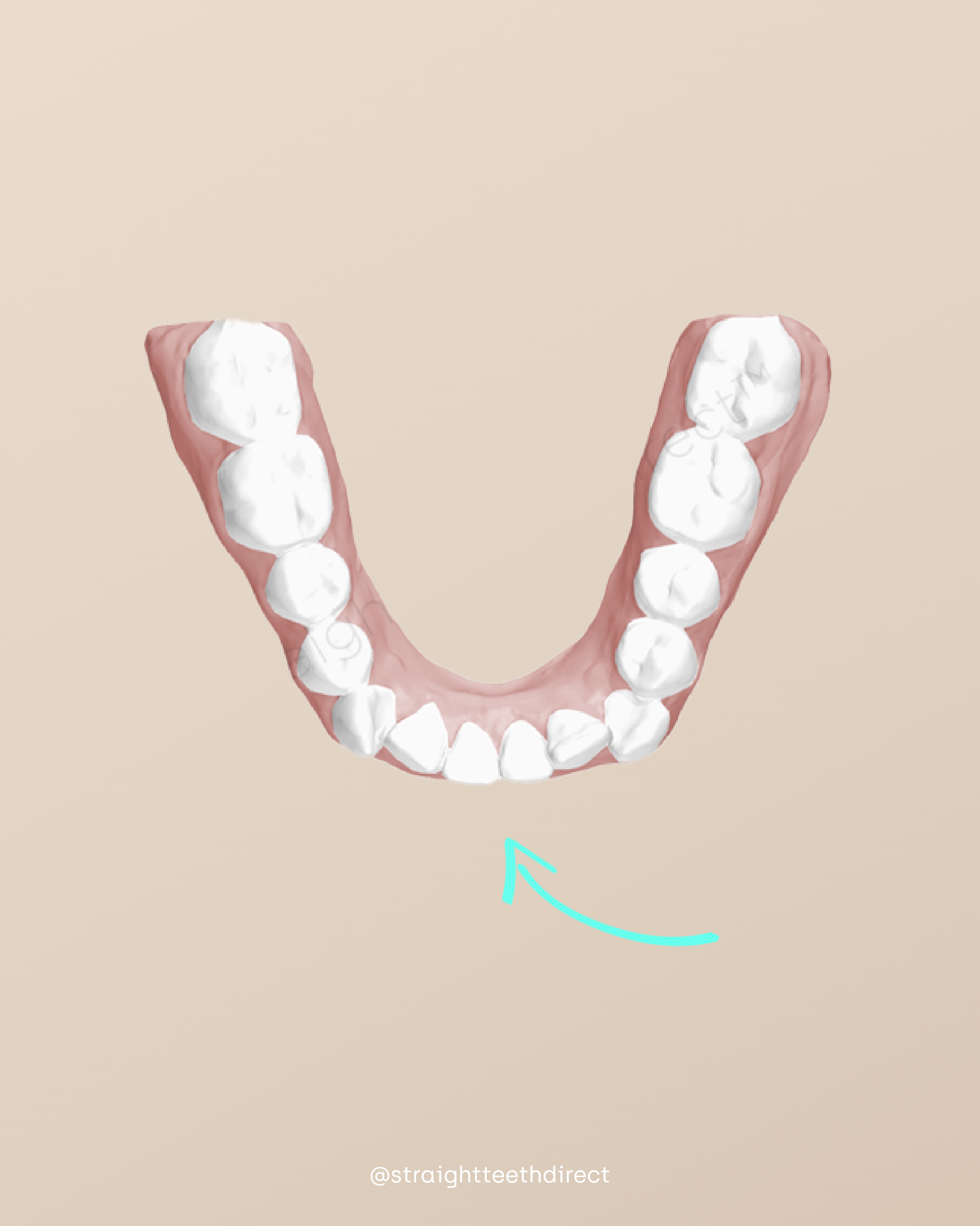 teeth shape illusion