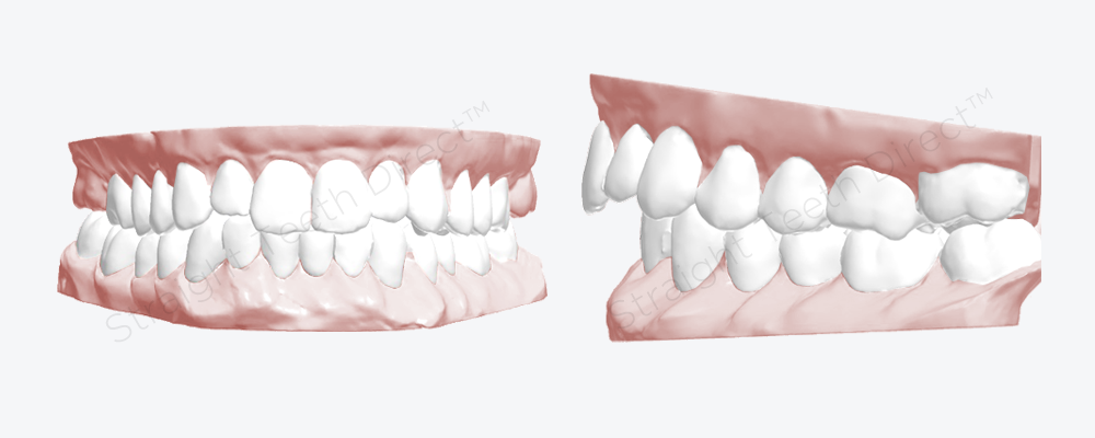 view-of-cosmetic-improvement-on-teeth