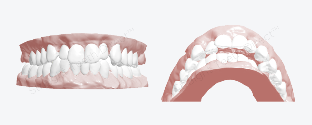 cosmetic-improvement