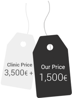 Ideal Smile Ideal Price