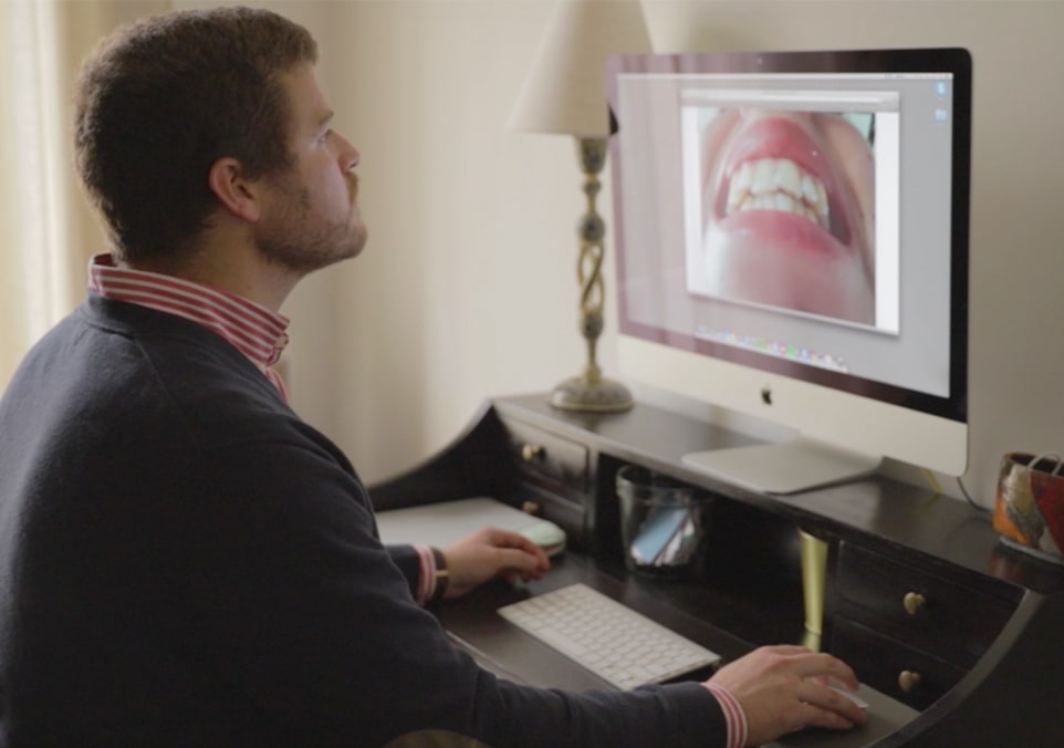 Straight Teeth Directâ„¢ An app that will literally make you smile