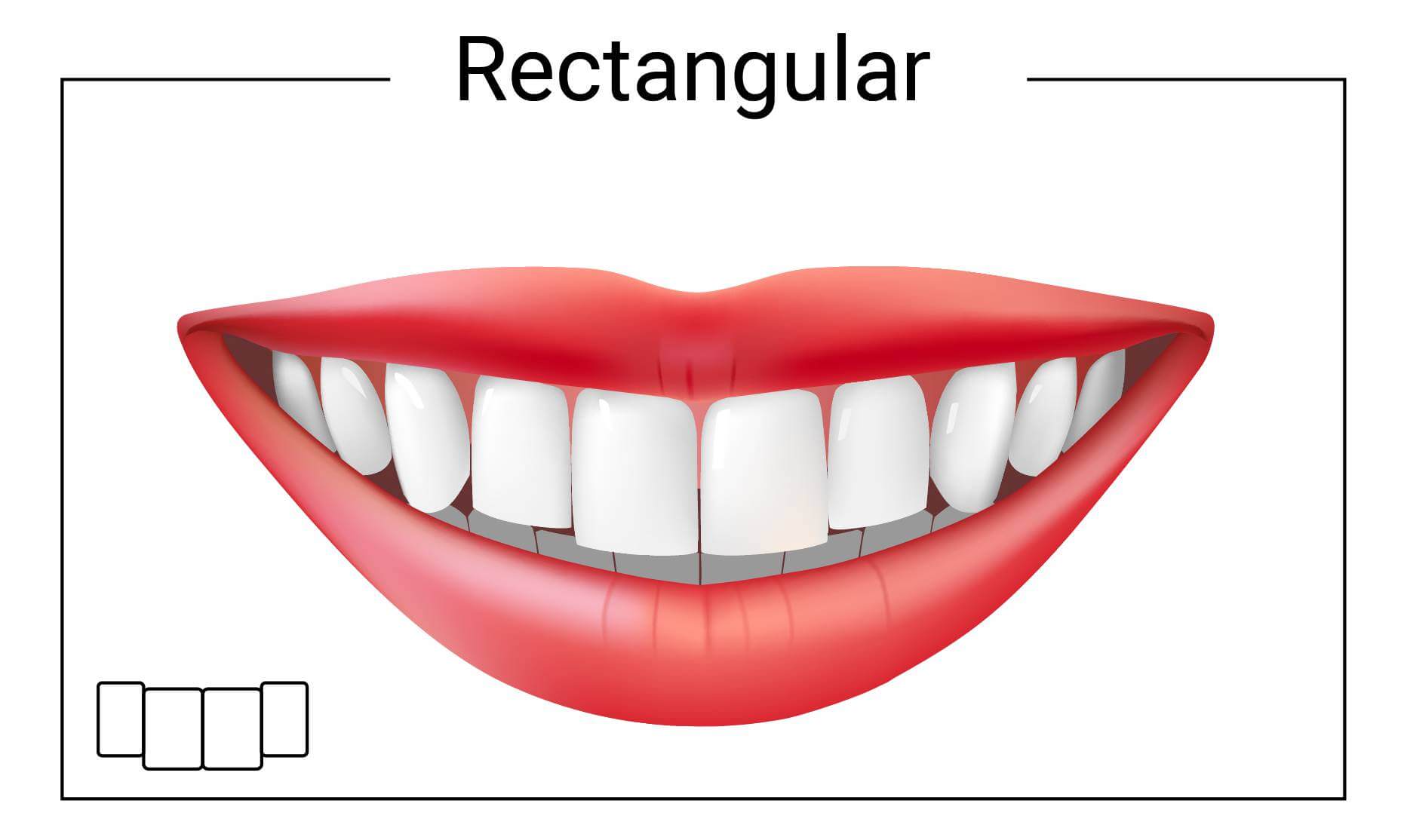 Forma dei denti rettangolari