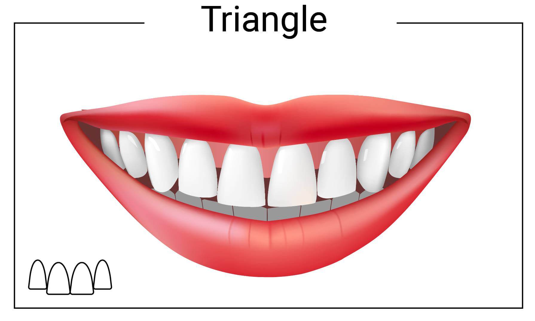 Forma triangolare dei denti