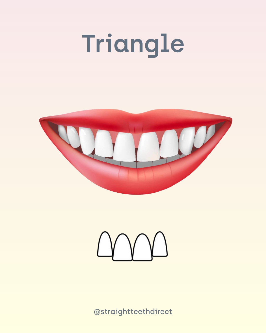 Triangle tooth shape