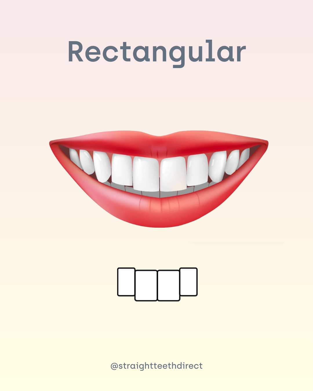 Rectangular tooth shape