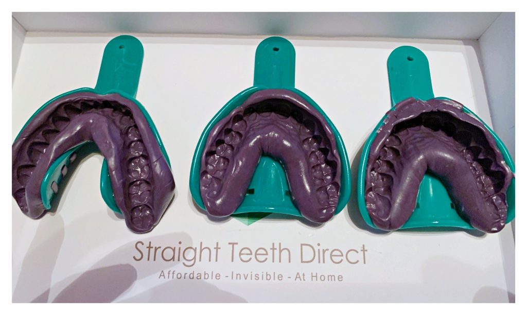 Curated visual reference: Gallery Detail: Online Teeth Straightening Ben S Own Straight Teeth Direct Journey