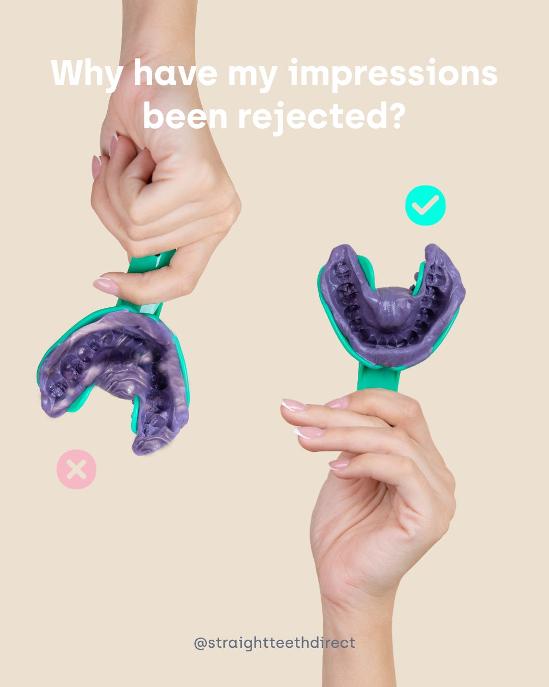 Rejected at home dental impressions