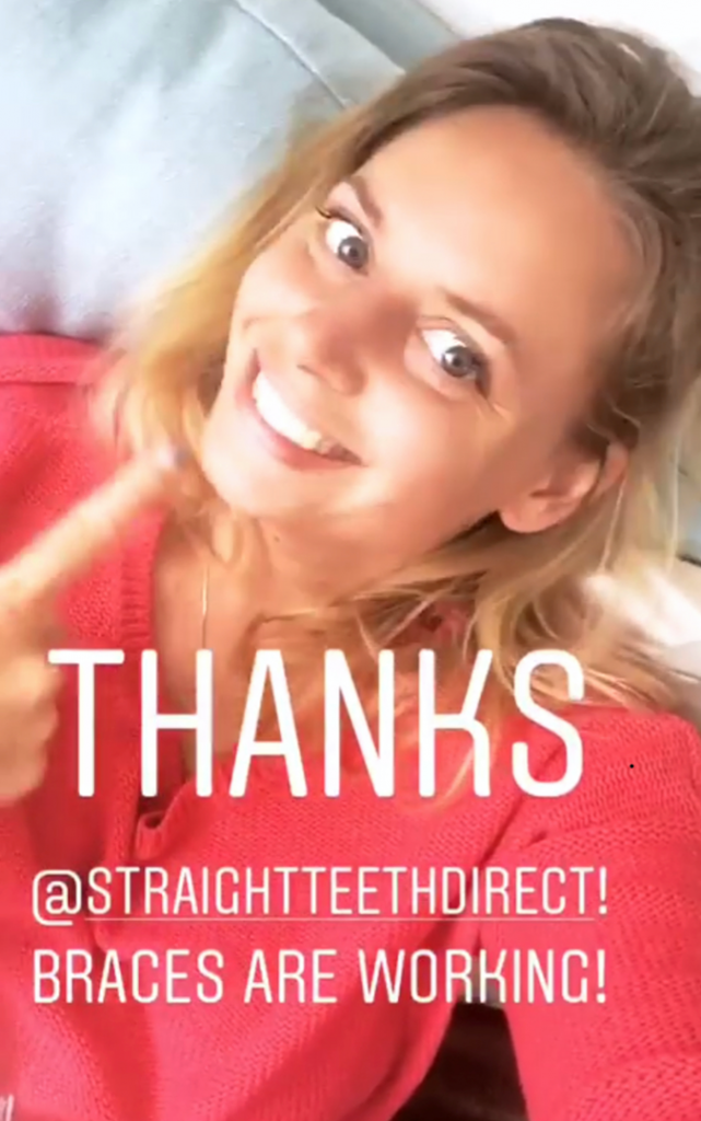 my smile delivered
