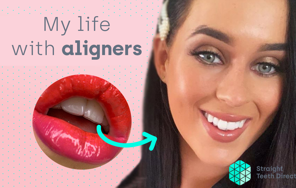 Maisie cover - convenient invisible aligners