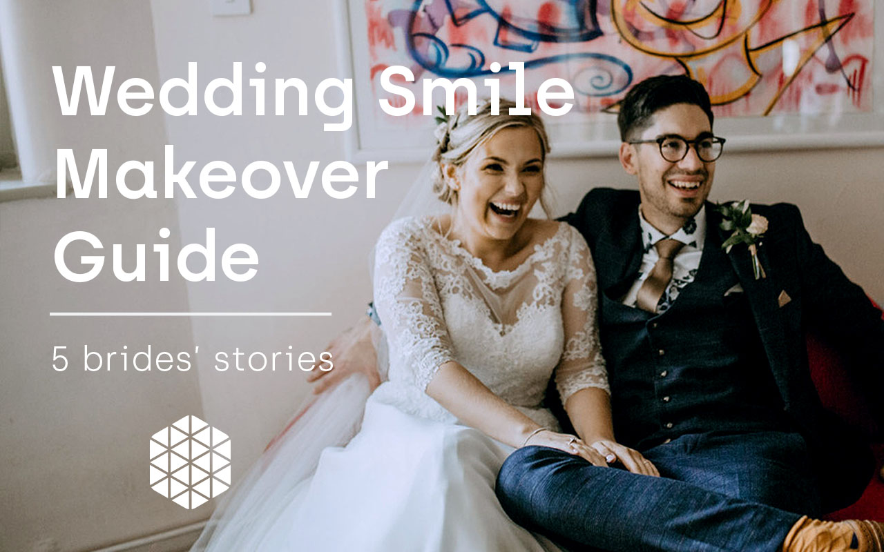 wedding smile makeover