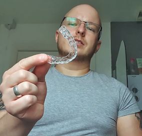 Straight Teeth Direct Review by Niall