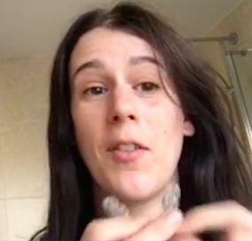 Straight Teeth Direct Review by Victoria