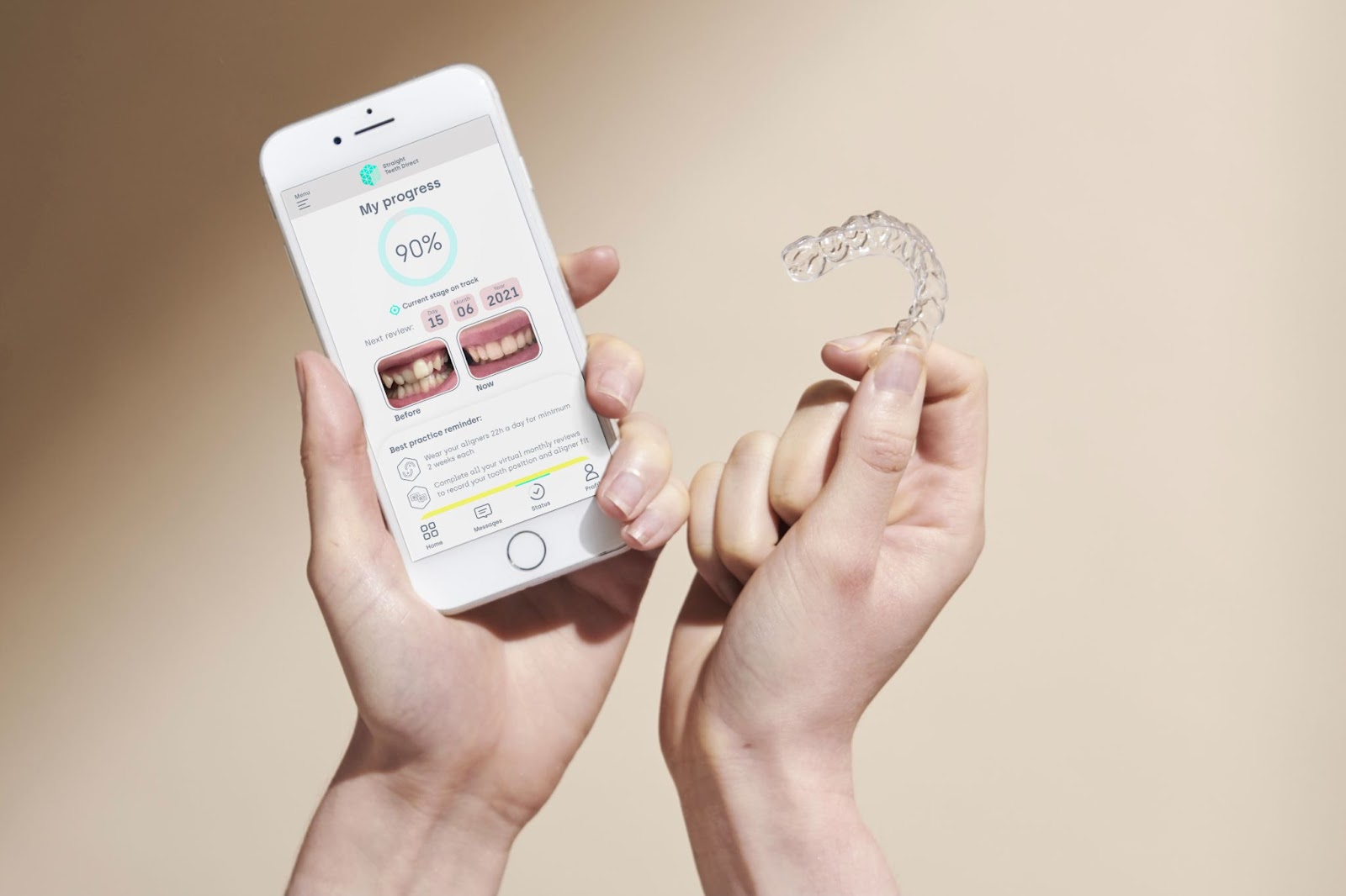 app screen % progress for dental monitoring