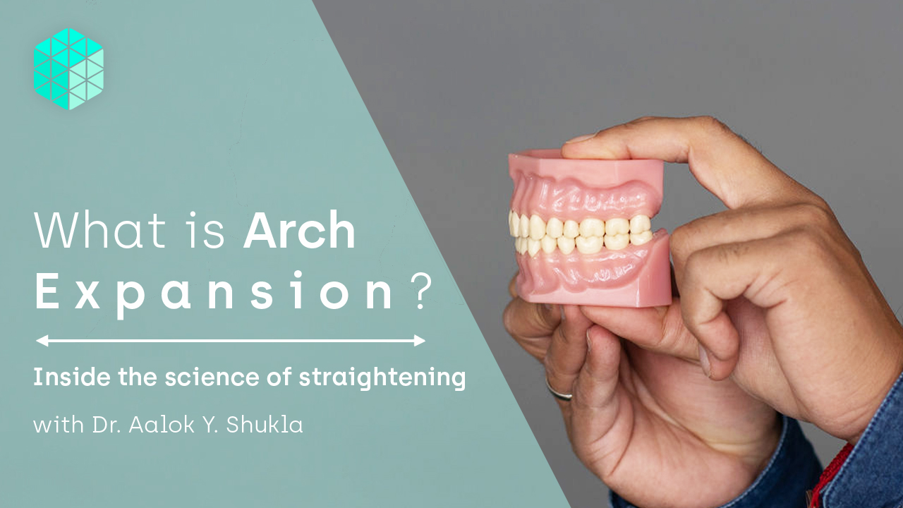 Arch expansion in orthodontics