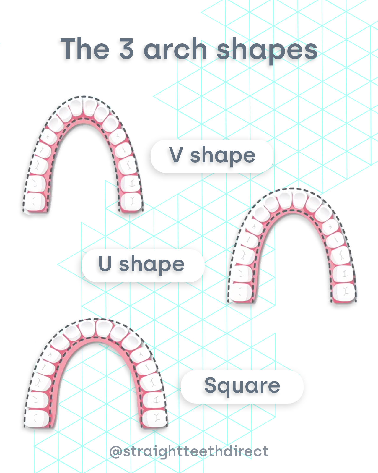 different dental arch shapes