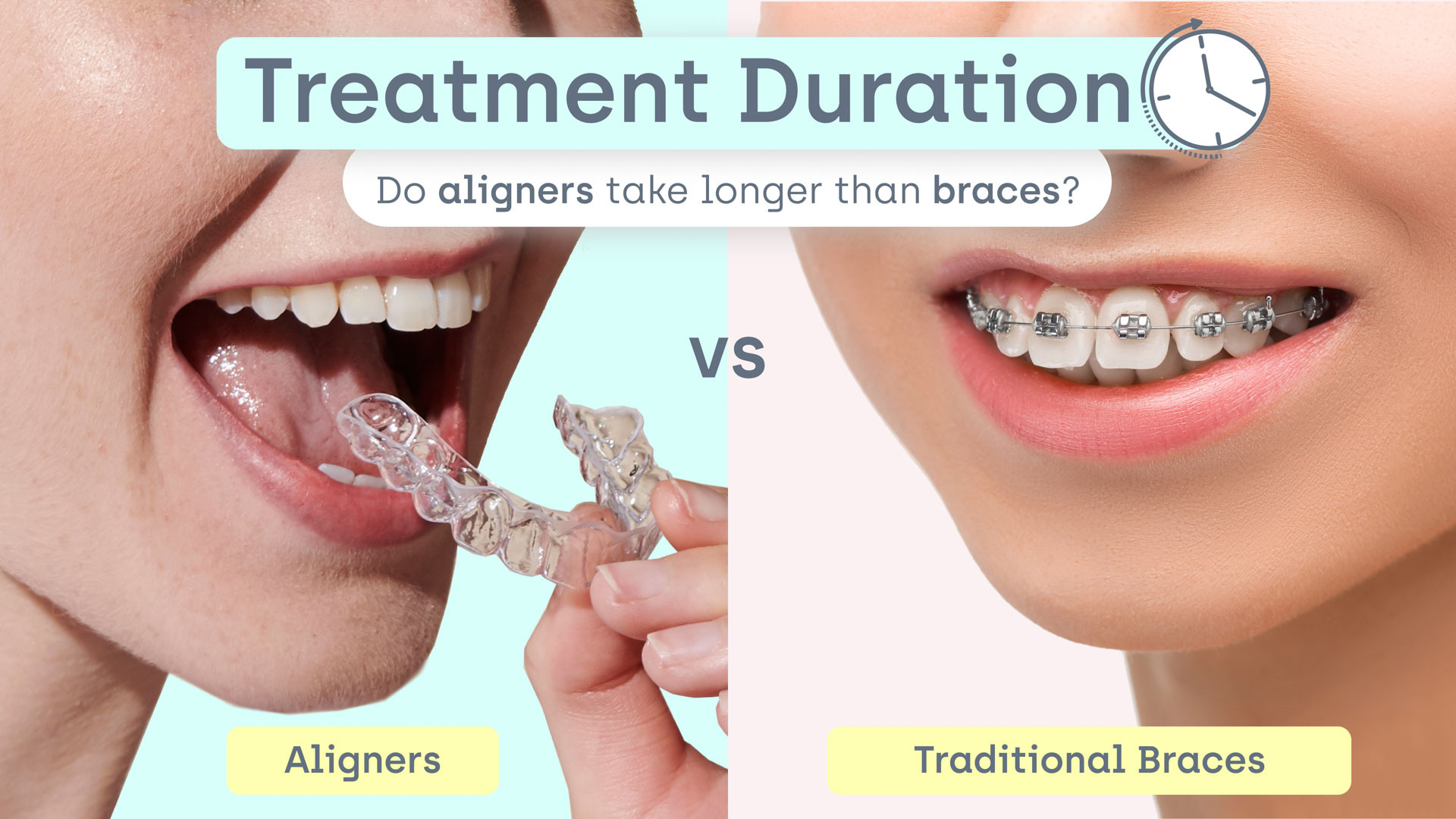how long to braces take vs aligners