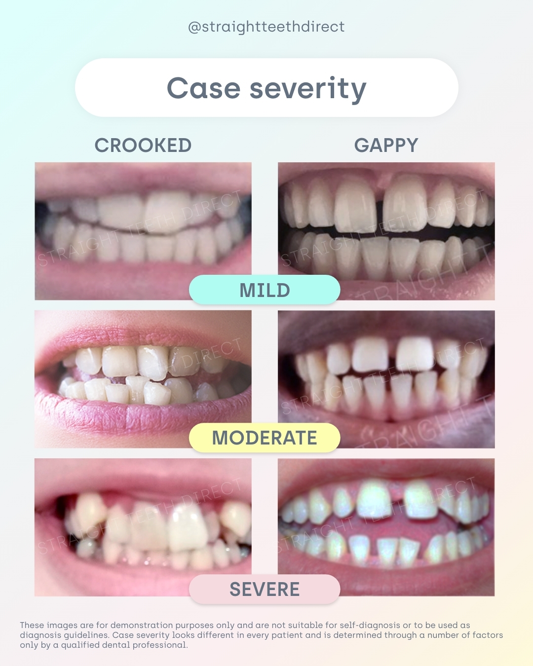 Case severity