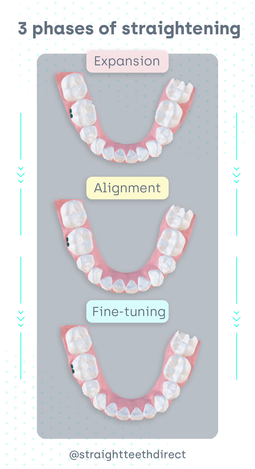 3 phases of teeth straightening