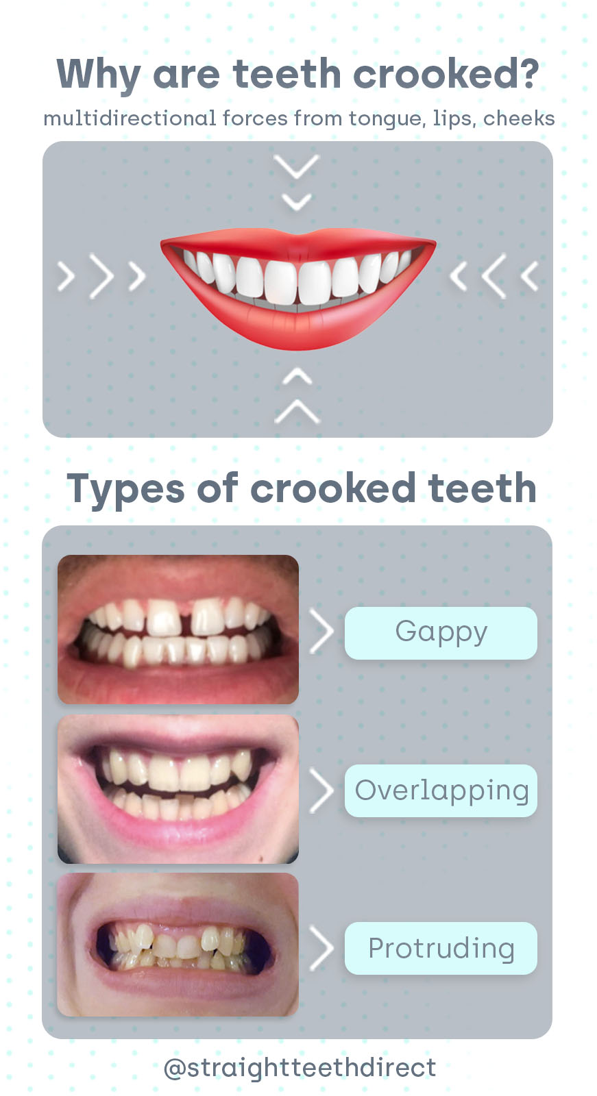 types of crooked teeth