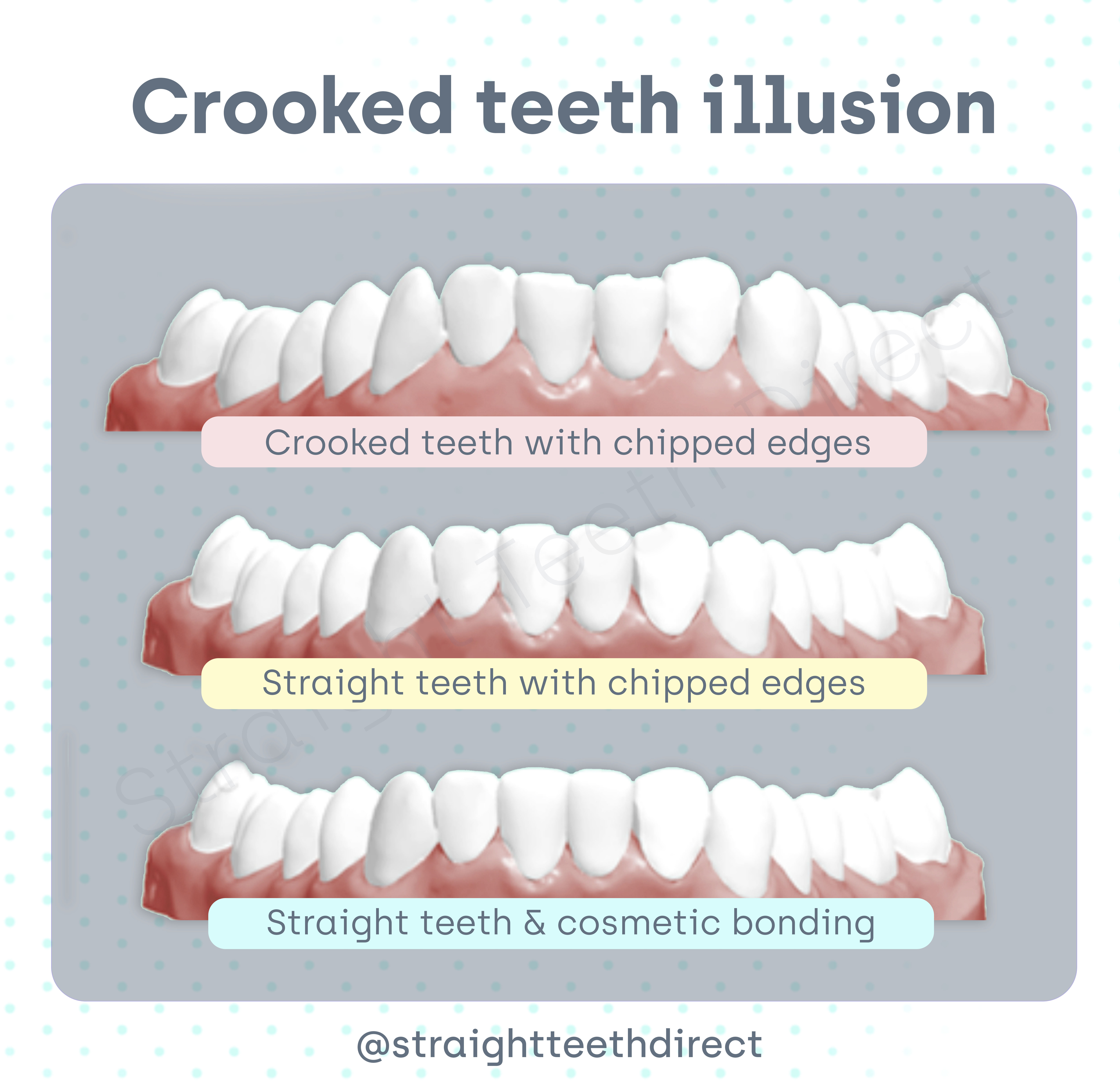crooked teeth illusion