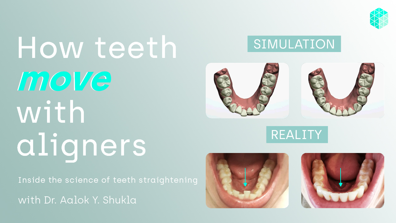 How do aligners work to move teeth
