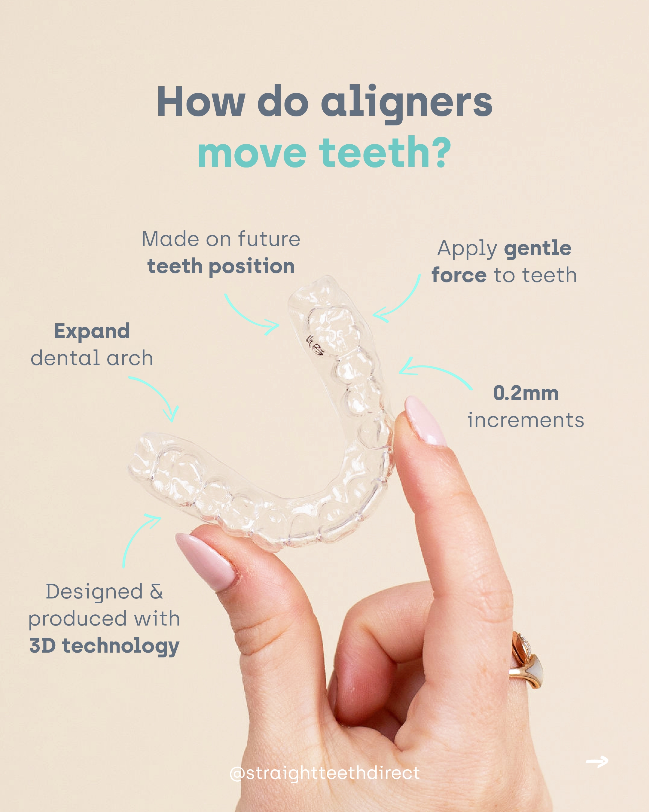 How aligners move teeth inforgraphic