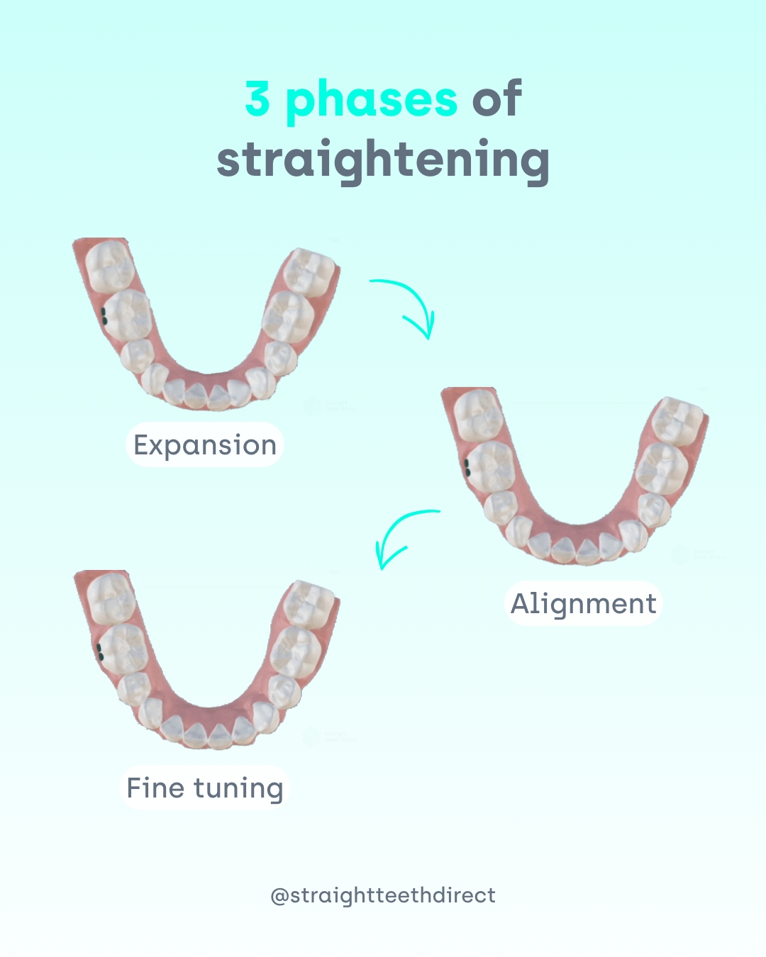 3 phases of straightening