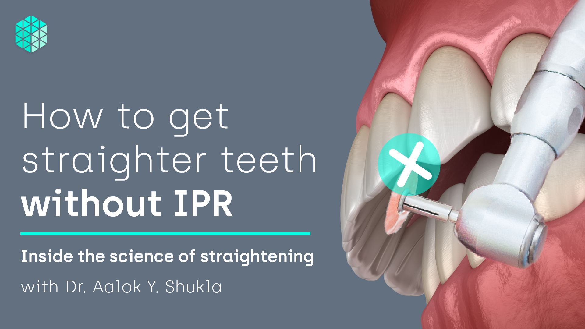 How to get straighter teeth without IPR