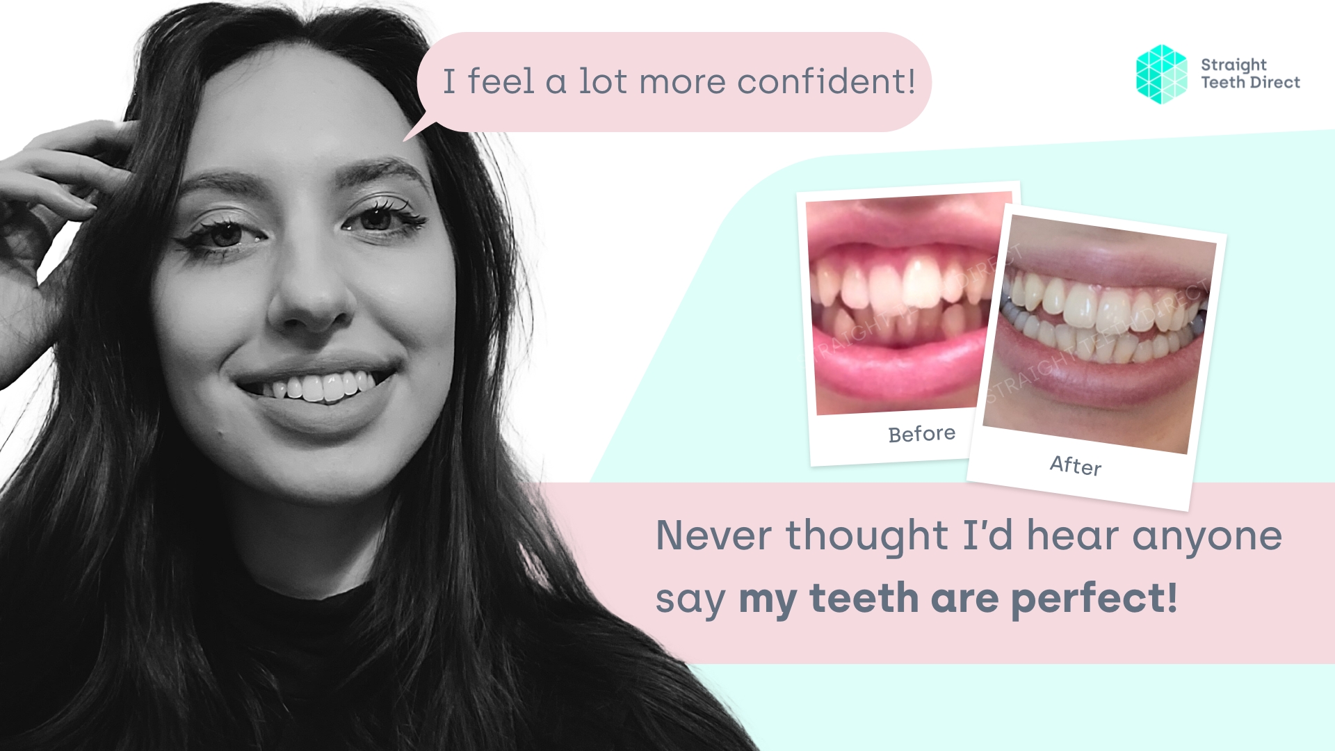 Helena guest blog with before and after with straight teeth after aligners