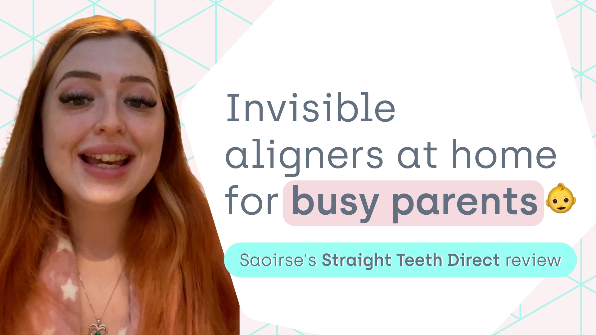Saoirse clear aligners review