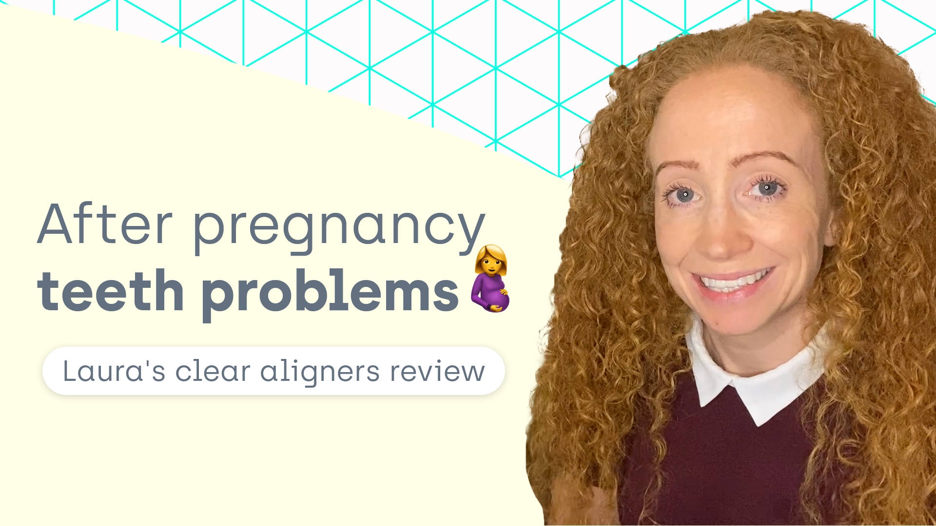 Straight Teeth Direct guest blog review