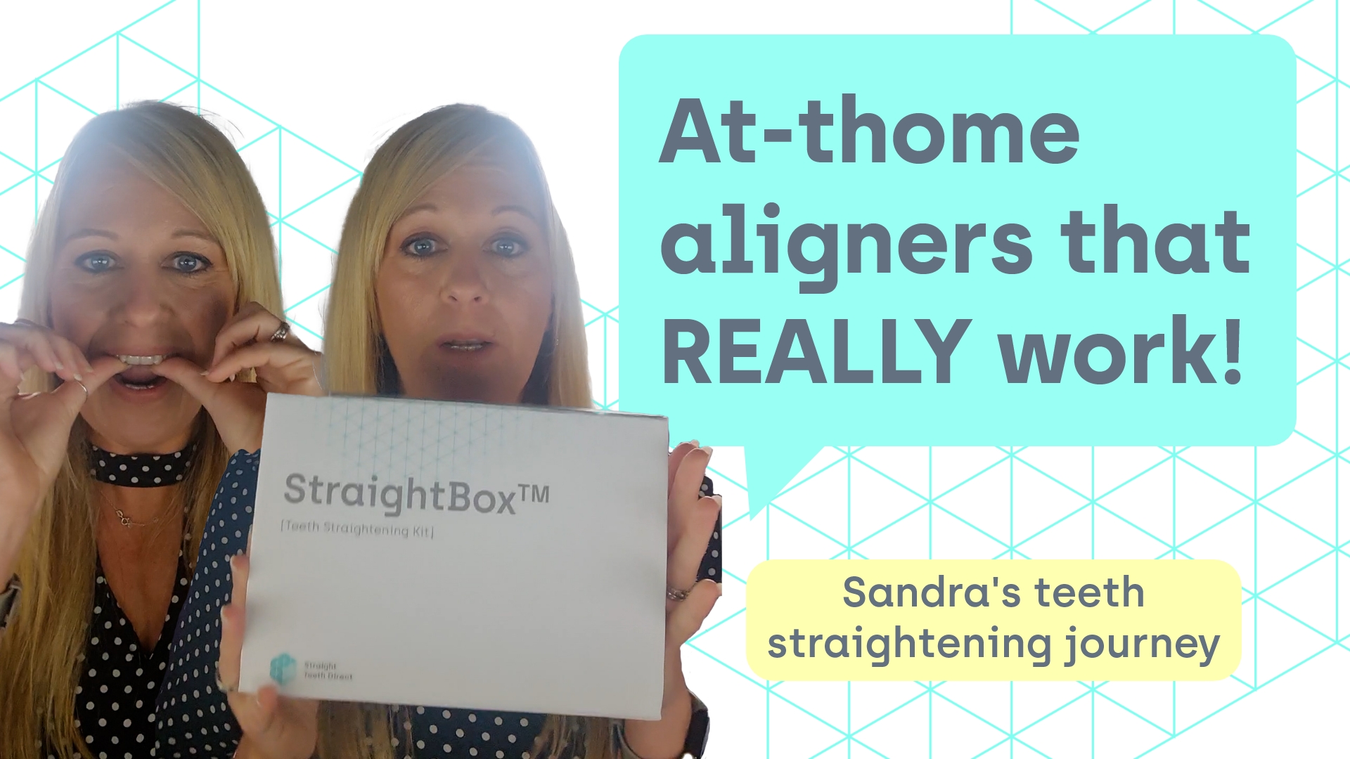 Aligners that REALLY work | teeth straightening treatment review