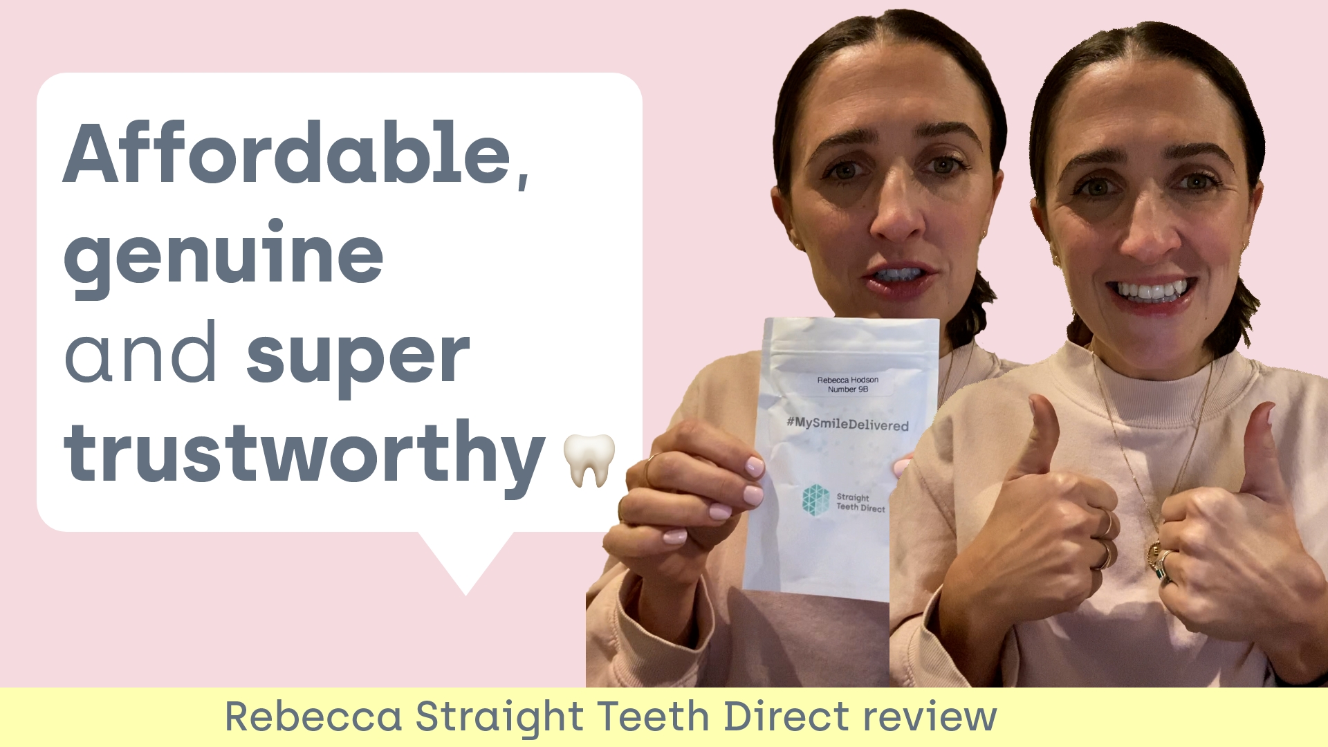 Do clear aligners work? Rebecca review