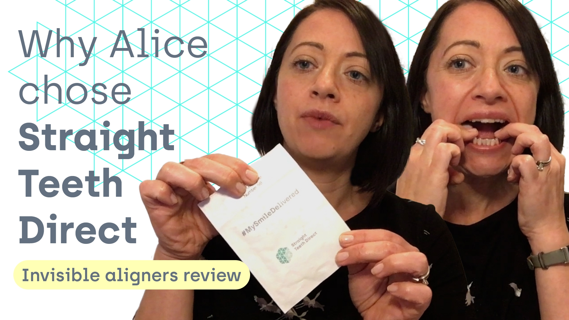 Alice Straight Teeth Direct review