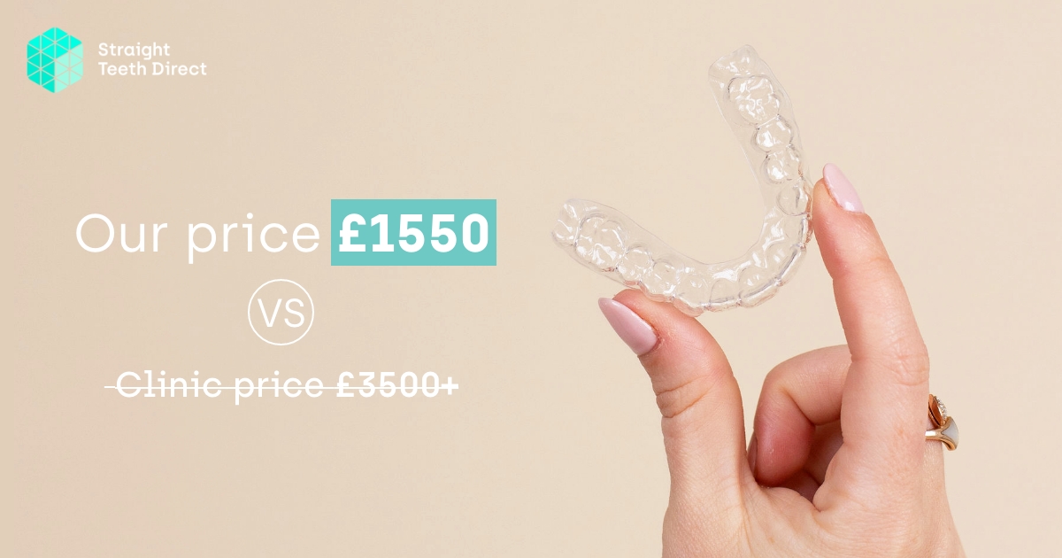 Straight Teeth Direct Pricing Clear aligners cost made simple